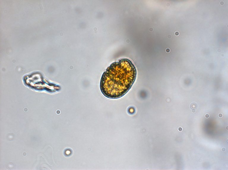 Cochlodinium spp. – California HABMAP